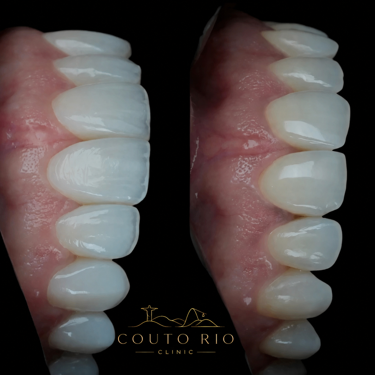 Resultado Couto Rio Clinic 4